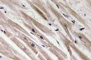 Immunohistochemistry (IHC) analyzes of Caspase12 antibody in paraffin-embedded human heart tissue. (Caspase 12 Antikörper)
