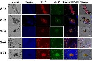 Immunofluorescence (Paraffin-embedded Sections) (IF (p)) image for anti-Keratin 17 (KRT17) antibody (ABIN2855697)