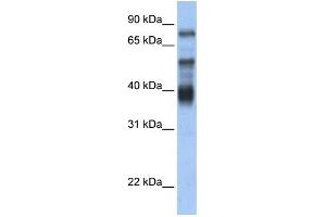 WB Suggested Anti-ZNF395 Antibody Titration:  0. (ZNF395 Antikörper  (Middle Region))