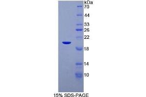 SDS-PAGE (SDS) image for CCAAT/enhancer Binding Protein (C/EBP), gamma (CEBPG) (AA 1-150) protein (His tag) (ABIN1878656)