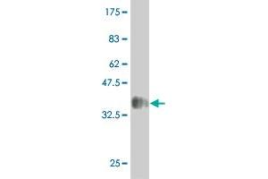 Western Blot detection against Immunogen (38. (MAP2K5 Antikörper  (AA 1-120))