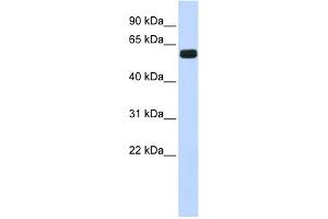 WB Suggested Anti-HIC2 Antibody Titration:  0. (HIC2 Antikörper  (Middle Region))