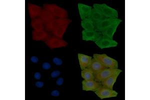 ABIN6257667 and ABIN6274155 staining Hela cells(30 min of UV treatment) by IF/ICC. (ADRA2A Antikörper  (Internal Region))