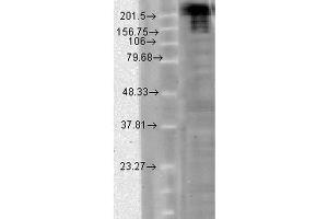Western Blot analysis of hamster CHO cells showing detection of Nav1. (SCN9A Antikörper  (AA 1751-1946) (APC))