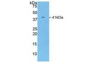 Western Blotting (WB) image for anti-Proteasome (Prosome, Macropain) 26S Subunit, Non-ATPase, 7 (PSMD7) (AA 1-324) antibody (ABIN7439741)