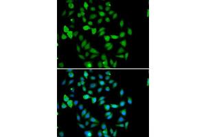 Immunofluorescence analysis of U2OS cells using STAMBP antibody. (STAMBP Antikörper  (AA 100-270))