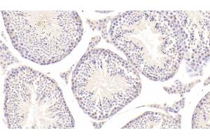 Detection of tPA in Mouse Testis Tissue using Polyclonal Antibody to Tissue Plasminogen Activator (tPA) (PLAT Antikörper  (AA 359-532))