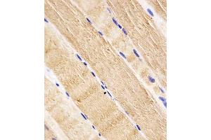 Immunohistochemistry (Paraffin-embedded Sections) (IHC (p)) image for anti-RAB7A, Member RAS Oncogene Family (RAB7A) (AA 176-204), (C-Term) antibody (ABIN652609)