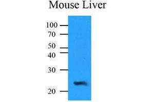 Western Blotting (WB) image for anti-NQO2 (NQO2) antibody (ABIN567621) (NQO2 Antikörper)
