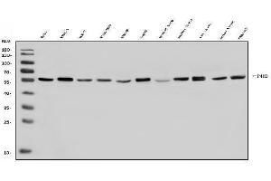 Western blot analysis of P4HB using anti-P4HB antibody (ABIN7600075).
