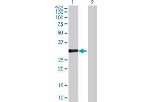 Western Blot analysis of CDCA8 expression in transfected 293T cell line by CDCA8 MaxPab polyclonal antibody. (CDCA8 Antikörper  (AA 1-280))