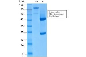SDS-PAGE Analysis of Purified CK HMW Rabbit Recombinant Monoclonal Antibody (KRTH/2147R). (Rekombinanter Cytokeratin 2 Antikörper)