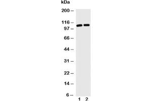 Western blot with TRIF antibody and Lane 1: Jurkat;  2: HL-60 cell lysate