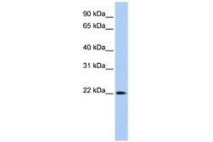 Image no. 1 for anti-Deoxyribonuclease II beta (DNASE2B) (C-Term) antibody (ABIN6743113) (DNASE2B Antikörper  (C-Term))