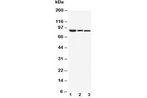 Western blot testing of beta Catenin antibody and Lane 1:  MM453;  2: MCF-7;  3: HeLa cell lysate (beta Catenin Antikörper  (AA 764-781))