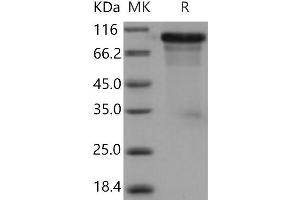 ECM1 Protein (His tag)