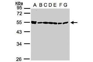 WB Image Sample(30μg whole cell lysate) A: 293T B: A431 , C: H1299 D: HeLa S3 , E: Hep G2 , F: MOLT4 , G: Raji , 10% SDS PAGE antibody diluted at 1:1000 (BAT1 Antikörper  (Center))