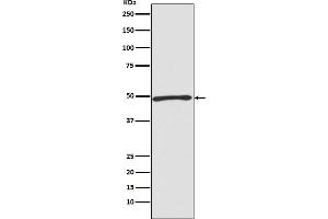 Western blot analysis of Atg4C expression in Jurkat cell lysate.