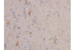 IHC-P analysis of Rat Cerebrum Tissue, with DAB staining. (Keratin 2 Antikörper  (AA 368-507))