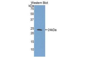 Western Blotting (WB) image for anti-Glutathione Synthetase (GSS) (AA 270-474) antibody (ABIN1859085) (Glutathione Synthetase Antikörper  (AA 270-474))