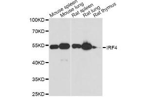Western blot analysis of extracts of various cell lines, using IRF4 antibody.
