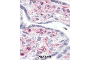 Immunohistochemistry (Paraffin-embedded Sections) (IHC (p)) image for anti-Interleukin-1 Receptor-Associated Kinase 1 (IRAK1) (AA 683-712), (C-Term) antibody (ABIN392233)