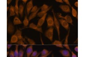 Immunofluorescence analysis of HeLa cells using UBQLN2 Polyclonal Antibody at dilution of 1:100 (40x lens). (Ubiquilin 2 Antikörper)