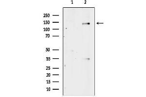 Western blot analysis of lysates from heat-shock treated Hela cells, using Phospho-Abl (Tyr412) Antibody.