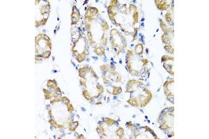 Immunohistochemistry of paraffin-embedded human stomach using ST6G antibody (ABIN6130083, ABIN6148536, ABIN6148538 and ABIN6221427) at dilution of 1:100 (40x lens). (ST6GAL1 Antikörper  (AA 27-200))