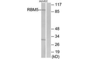 Western blot analysis of extracts from HuvEc cells, using RBM5 Antibody. (RBM5 Antikörper  (AA 226-275))