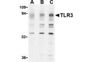 Western blot analysis of TLR3 in K562 cell lysate with this product at (A) 0.