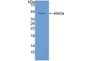 Detection of Recombinant ECF, Rat using Polyclonal Antibody to Eosinophil Chemotactic Factor (ECF) (ECF Antikörper  (AA 24-97))