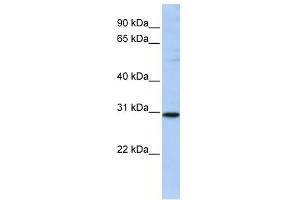 RAB26 antibody used at 1 ug/ml to detect target protein. (RAB26 Antikörper  (N-Term))