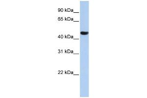 WB Suggested Anti-ZNF286A Antibody Titration:  0. (ZNF286A Antikörper  (N-Term))