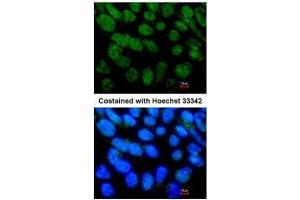 ICC/IF Image Immunofluorescence analysis of paraformaldehyde-fixed Human ESC, using NR5A2, antibody at 1:400 dilution. (NR5A2 + LRH1 Antikörper)