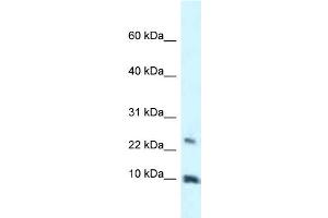 WB Suggested Anti-HMGN3 Antibody Titration: 1.