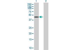Western Blot analysis of C10orf88 expression in transfected 293T cell line by C10orf88 MaxPab polyclonal antibody. (C10orf88 Antikörper  (AA 1-445))