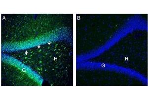 Expression of NrCAM in rat hippocampus. (NrCAM Antikörper  (Extracellular, N-Term))
