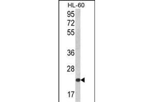 Western blot analysis of KLRC2 Antibody (N-term) (ABIN652570 and ABIN2842383) in HL-60 cell line lysates (35 μg/lane).