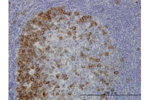 Image no. 1 for anti-Transforming, Acidic Coiled-Coil Containing Protein 3 (TACC3) (AA 1-101) antibody (ABIN6745991) (TACC3 Antikörper  (AA 1-101))