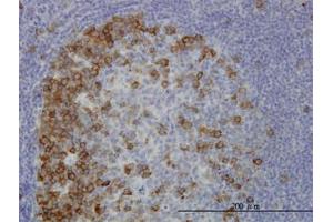 Image no. 1 for anti-Transforming, Acidic Coiled-Coil Containing Protein 3 (TACC3) (AA 1-101) antibody (ABIN6745991)