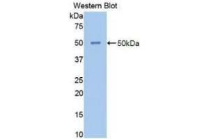Detection of Recombinant NSE, Human using Polyclonal Antibody to Enolase, Neuron Specific (NSE) (ENO2/NSE Antikörper  (AA 1-434))
