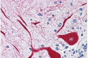 Immunohistochemistry (Paraffin-embedded Sections) (IHC (p)) image for anti-Inositol 1,4,5-Trisphosphate Receptor, Type 1 (ITPR1) (AA 1892-1911) antibody (ABIN337359)
