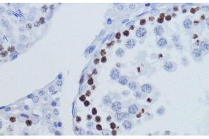 Immunohistochemistry of paraffin-embedded Rat testis using TriMethyl-Histone H3-K9 Polyclonal Antibody at dilution of 1:200 (40x lens).