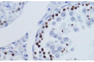 Immunohistochemistry of paraffin-embedded Rat testis using TriMethyl-Histone H3-K9 Polyclonal Antibody at dilution of 1:200 (40x lens). (Histone 3 Antikörper  (3meLys9))