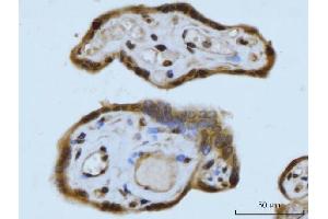 IHC analysis of SCP3/SYCP3 using anti-SCP3/SYCP3 antibody (ABIN7602415). (SYCP3 Antikörper  (AA 75-236))