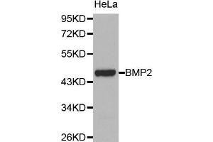 Western blot analysis of extracts of HeLa cell lines, using BMP2 antibody. (BMP2 Antikörper)