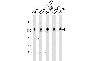 Western Blot at 1:2000 dilution Lane 1: Hela whole cell lysate Lane 2: MDA-MB-231 whole cell lysate Lane 3: HepG2 whole cell lysate Lane 4: SW480 whole cell lysate Lane 5: A549 whole cell lysate Lysates/proteins at 20 ug per lane.