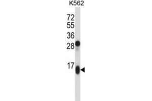 Western Blotting (WB) image for anti-Guanylate Cyclase Activator 2A (Guanylin) (GUCA2A) antibody (ABIN2997587) (GUCA2A Antikörper)