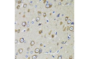 Immunohistochemistry of paraffin-embedded rat brain using RPS10 antibody (ABIN5973486) at dilution of 1/100 (40x lens). (RPS10 Antikörper)